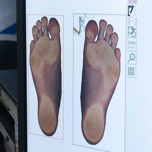 Fußscan zur Einlagenversorgung