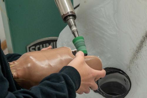 Anfertigung Prothese